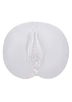 Bezhraničná vulva — obrázok 2