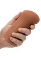 Bezhraničná vulva — obrázok 14